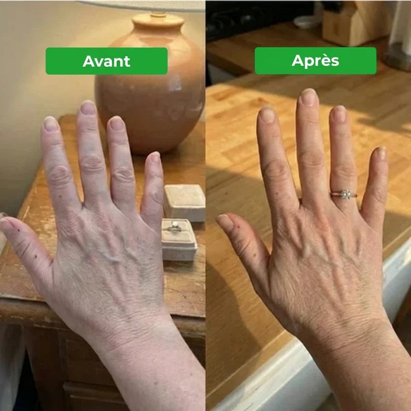 Drainant Lymphatique